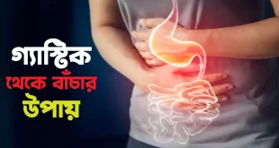 গ্যাস্ট্রিক থেকে বাঁচার উপায়