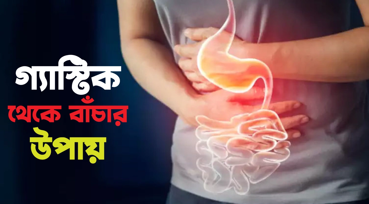 গ্যাস্ট্রিক থেকে বাঁচার উপায়